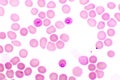 Malaria parasite in red blood cells