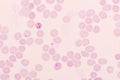 Malaria parasite in red blood cells