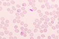 Malaria parasite in red blood cells