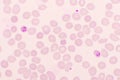 Malaria parasite in red blood cells