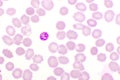 Malaria parasite in red blood cells