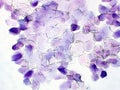 Malassezia yeast cytology of human epidermis