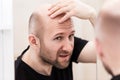 Bald man looking mirror at head baldness and hair loss Royalty Free Stock Photo