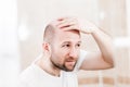 Bald man looking mirror at head baldness and hair loss Royalty Free Stock Photo