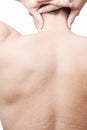 Male back with stretch marks Royalty Free Stock Photo