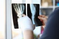 Male bandaged hand holds xray image closeup