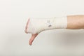 Male bandaged hand with thumb down sign