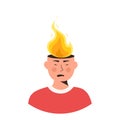 Male character head in fire vector flat illustration. Man or woman feeling stress at work, anger. Concept of emotional