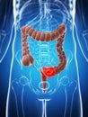 Male colon - cancer