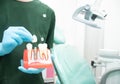 Male dentist carrying a sample of dental implants Royalty Free Stock Photo
