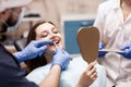 Patient`s teeth shade with samples for bleaching treatment. Royalty Free Stock Photo