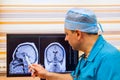 Male doctor examining a brain cat scan Royalty Free Stock Photo