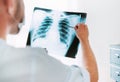 Male doctor examining the patient chest x-ray film lungs scan at radiology department in hospital.Covid-19 scan body xray test Royalty Free Stock Photo