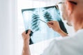 Male doctor examining the patient chest x-ray film lungs scan at radiology department in hospital.Covid-19 scan body xray test Royalty Free Stock Photo