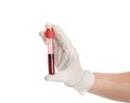 Male doctor holding test tube with blood sample on white, closeup. Medical object