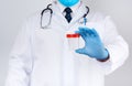 Male doctor in a white coat and tie stands and holds a plastic container for urine specimen