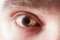 Male eye with mydriatic pupil Royalty Free Stock Photo