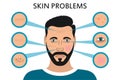 Male face skin problems. Acne and pimples, black spots, redness, dryness, circles under the eyes and wrinkles. Vector. Royalty Free Stock Photo