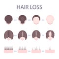 Male and female hair loss