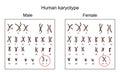 Male and female karyotype Royalty Free Stock Photo