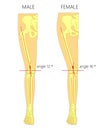 Male and female Q angle