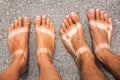 Male and female tanned feet.