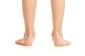 Male flatfoot legs Royalty Free Stock Photo