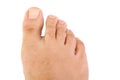 Male foot and toes