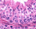 Male germinal epithelium. Spermatogenesis