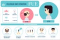 FUE treatment infographic for men