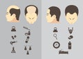 Male hair loss stages set. Man before and after hair treatment and hair transplantation. Male pattern baldness. Transplantation of