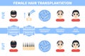 Male hair tranplantation with FUE, FUT methods Royalty Free Stock Photo