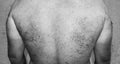 Male hairy back. Black and white photo.