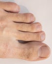 Male hairy toes. Nail fungus and crooked long fingers.