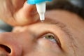 Male hand putting liquid drops in his eye solving vision problem Royalty Free Stock Photo