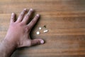 Male hand stung by bee and medication for swelling next to it. Hand swelling, inflammation, redness are signs of infection. Insect Royalty Free Stock Photo