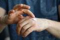 Male hands applying moistening cream on skin