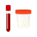 Male infertility tests. Blood and semen analysis. Blood in glass tube and sperm in plastic container isolated on white
