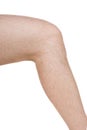 Male knee Royalty Free Stock Photo