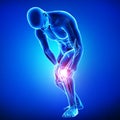 Male knee pain