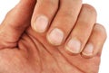 Male left hand fingers with dirt under the nails, closeup macro, isolated