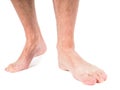 Male person with hairy legs Royalty Free Stock Photo