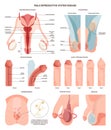 Male reproductive system disorder set. External and internal organs