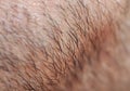 Male skin texture covered with fine and coarse hairs and bristles