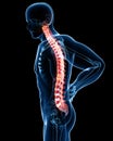 Male spine pain anatomy in blue