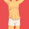 Male Torso with Sagging Belly, Human Body After Weight Loss, Front View, Obesity and Unhealthy Eating Problems Vector