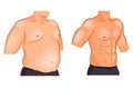 Male torso before and after weight loss and sports