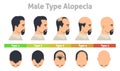 Male type alopecia poster hair loss stage Royalty Free Stock Photo