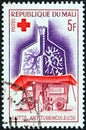 MALI - CIRCA 1965: A stamp printed in Mali shows lungs and mobile X-Ray Unit Anti-T.B., circa 1965.