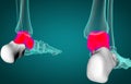 3D illustration of malleolus or talus foot bone